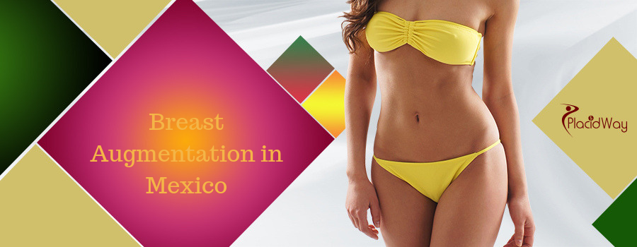 Breast Augmentation in Mexico